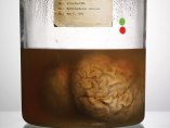 Hydrocephalus internus, May 6, 1970 Hydrocephalus internus, May 6, 1970