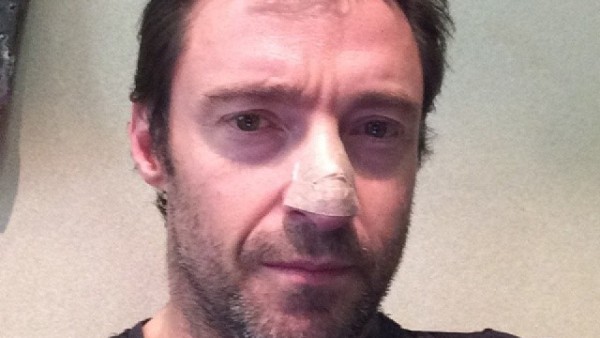Hugh Jackman Hugh Jackman