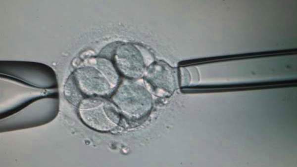 Biopsia Biopsia